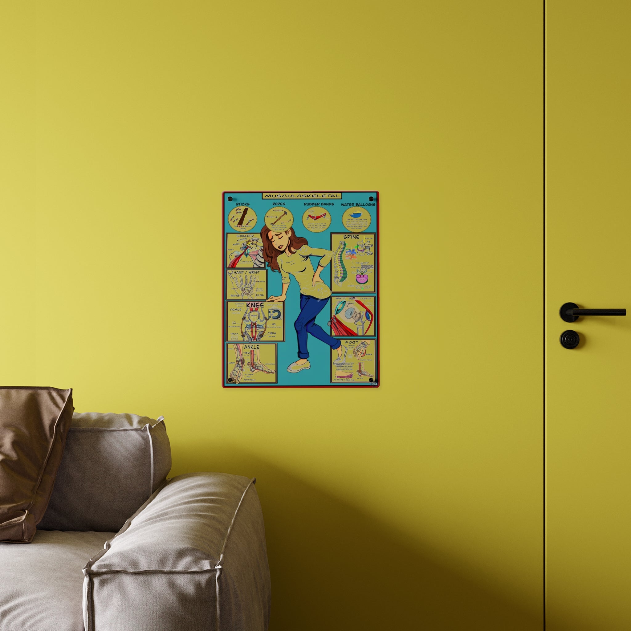 Musculoskeletal Acrylic Wall Art Panel for Patient Education in Clinics and Hospitals