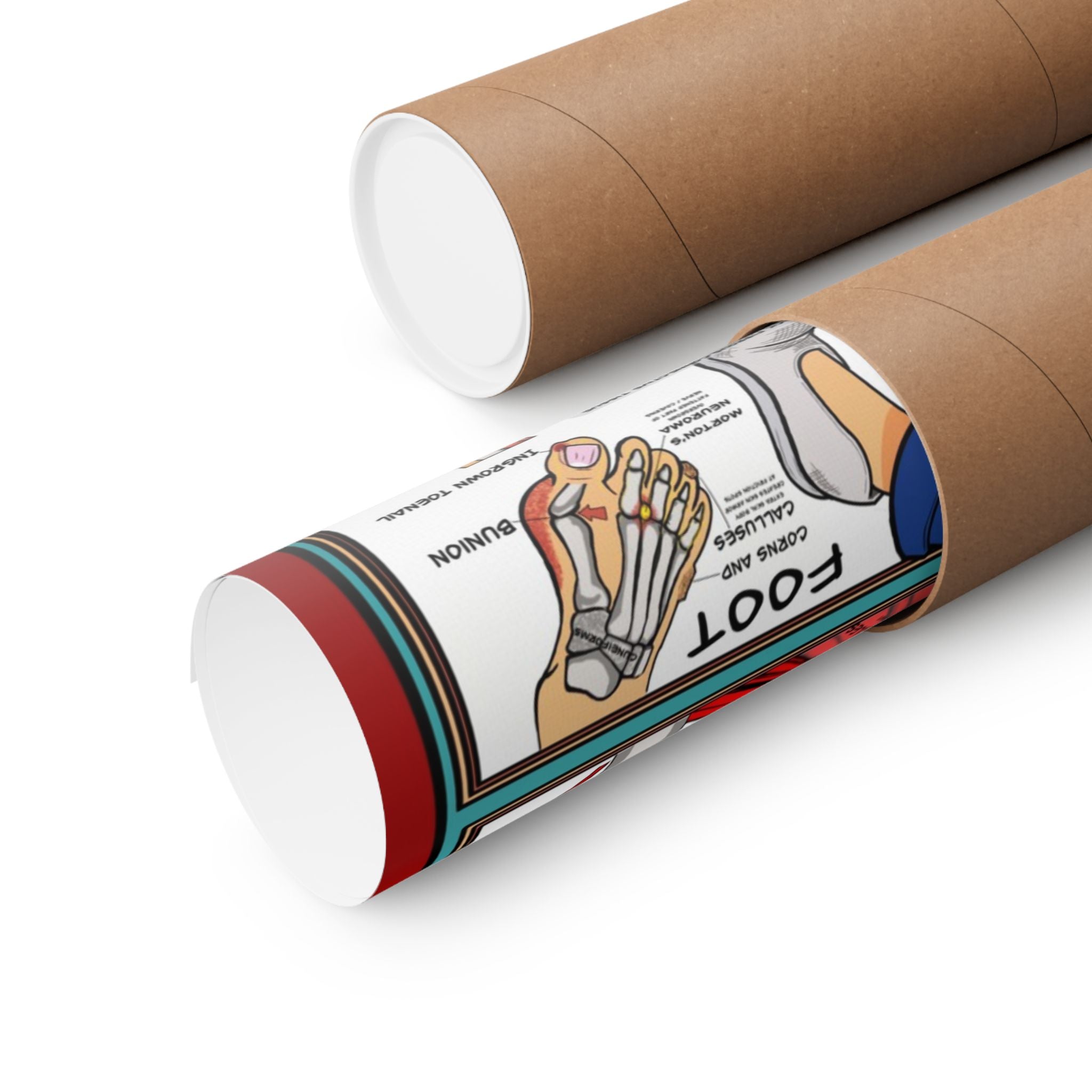 Musculoskeletal Poster for Patient Education in Clinics and Hospitals