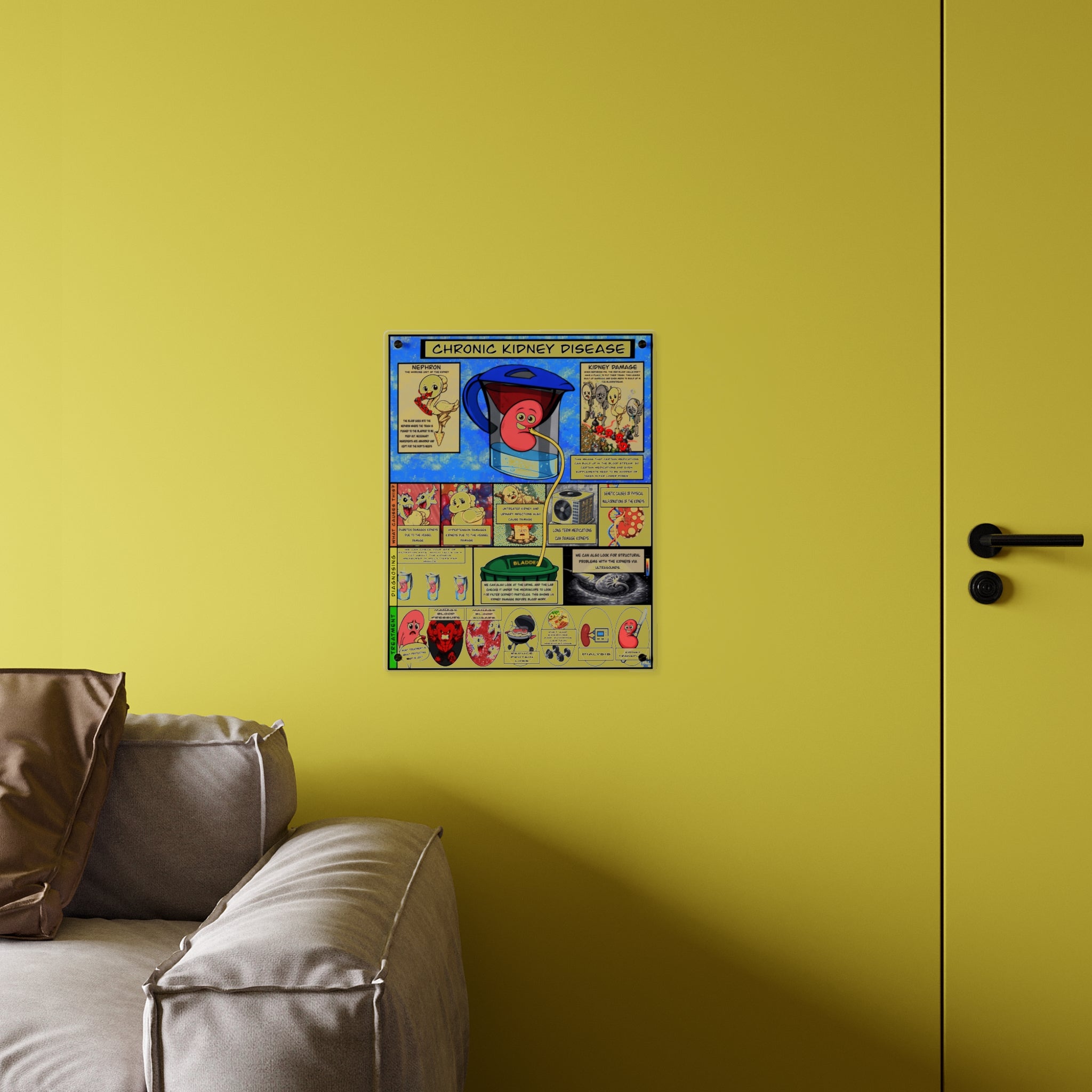 Chronic Kidney Disease Acrylic Wall Art Panel for Patient Education in Clinics and Hospitals