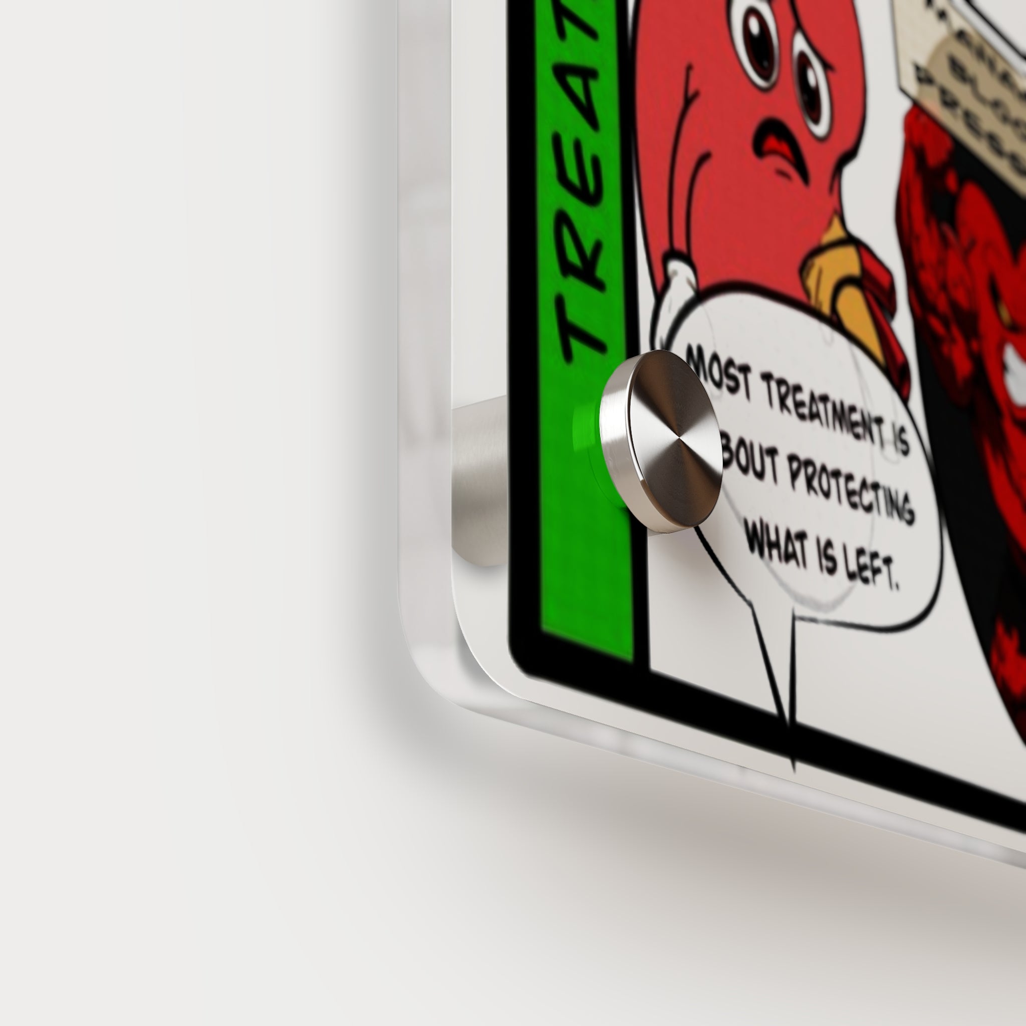 Chronic Kidney Disease Acrylic Wall Art Panel for Patient Education in Clinics and Hospitals