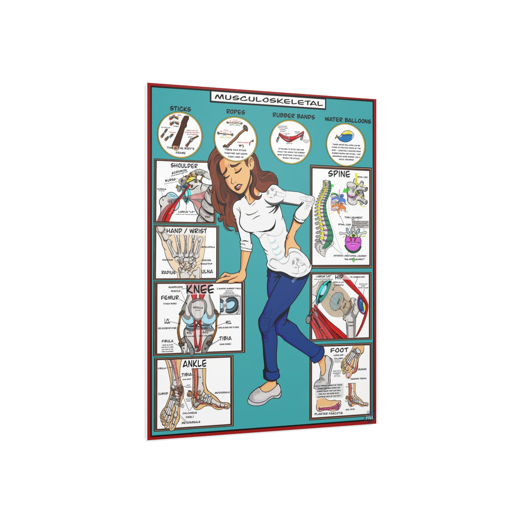 Musculoskeletal Foam Board Patient Education for Clinics and Hospitals