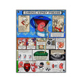 Chronic Kidney Disease Acrylic Wall Art Panel for Patient Education in Clinics and Hospitals