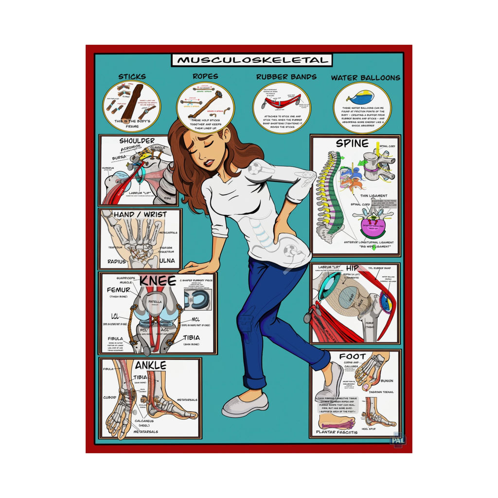 Musculoskeletal Poster for Patient Education in Clinics and Hospitals