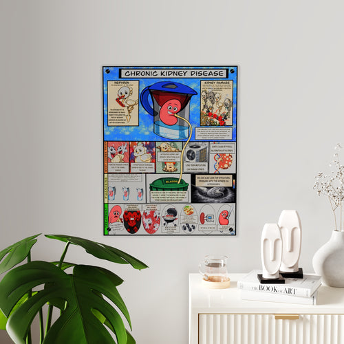 Chronic Kidney Disease Acrylic Wall Art Panel for Patient Education in Clinics and Hospitals