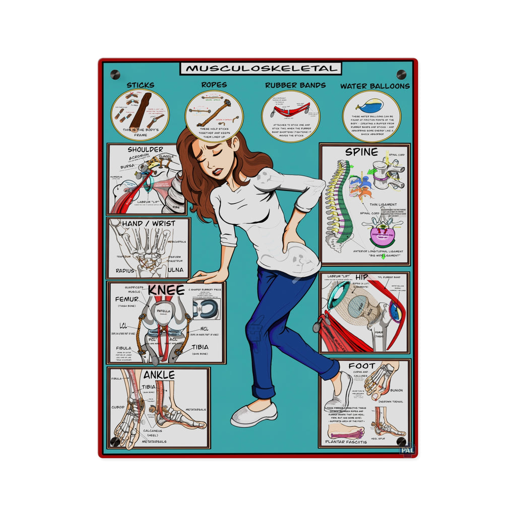 Musculoskeletal Acrylic Wall Art Panel for Patient Education in Clinics and Hospitals