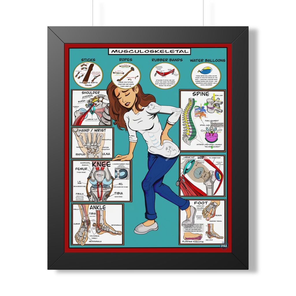 Musculoskeletal Infographic for Patient Education in Clinics and Hospitals