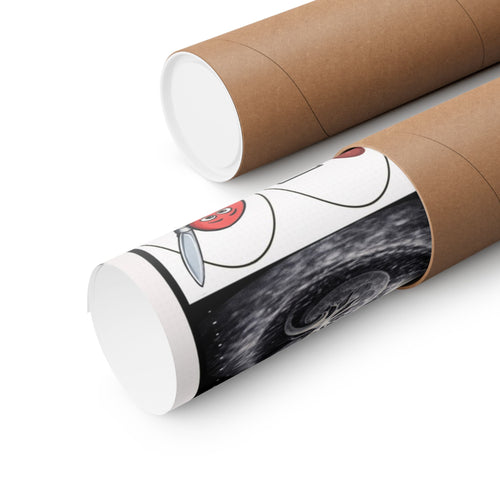 Chronic Kidney Disease Poster for Patient Education in Clinics and Hospitals