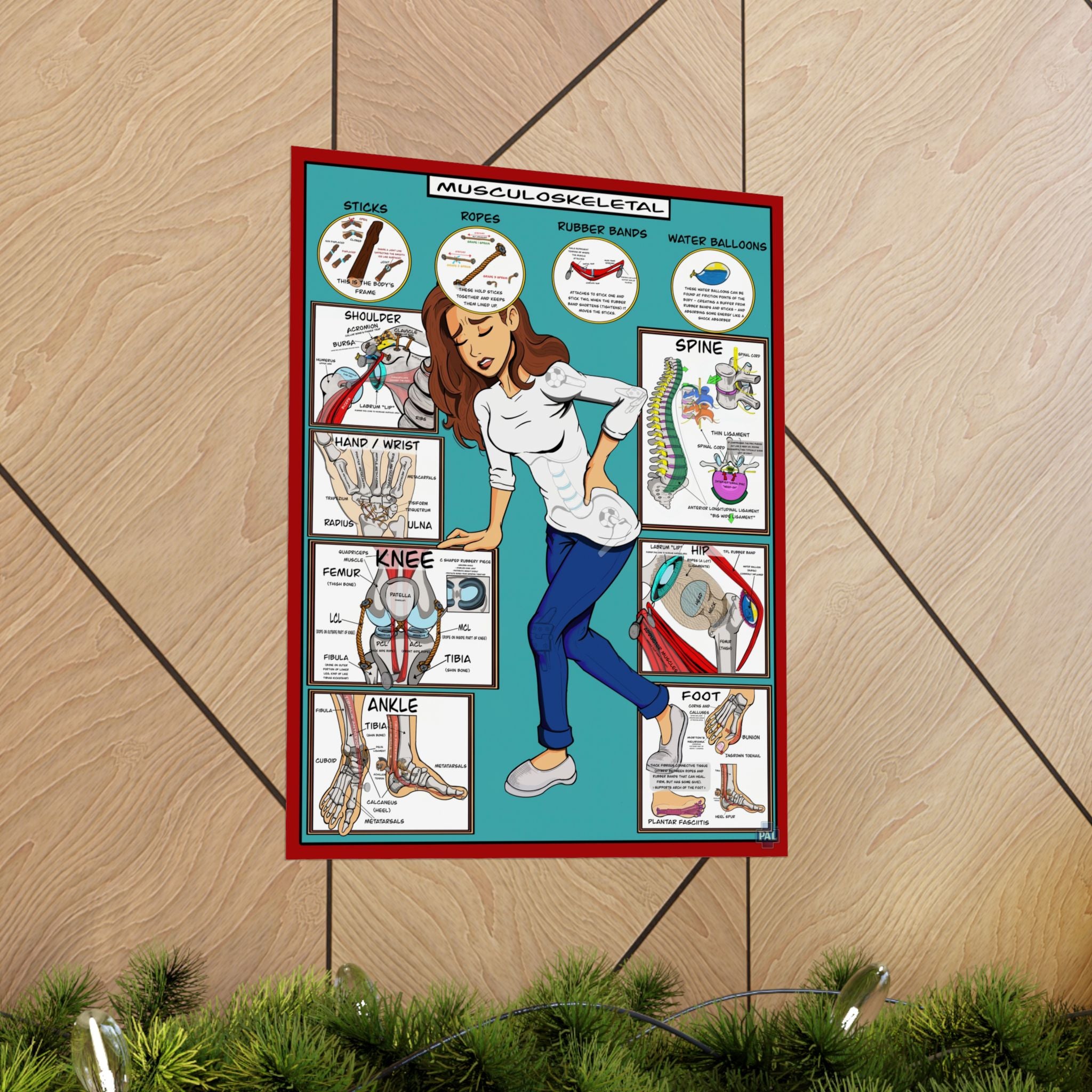 Musculoskeletal Poster for Patient Education in Clinics and Hospitals